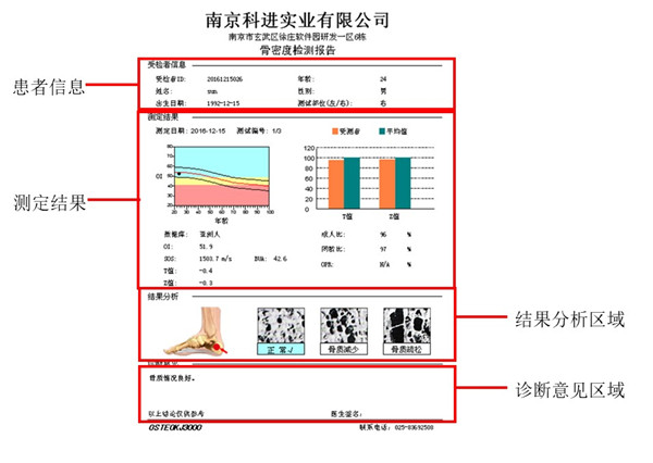 超聲骨密度診斷儀OsteoKJ3000診斷報(bào)告.jpg